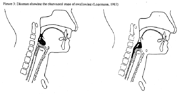 NONINVASIVE MONITORING OF REFLEXIVE SWALLOWING