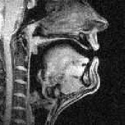 MRI image of IH vowel