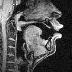 MRI image of OO vowel