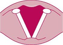VF Apart